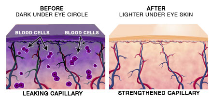 capillaries